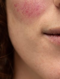 AdobeStock_287991266-1