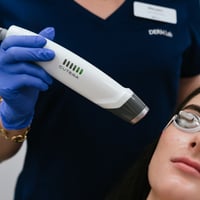 Genesis V Laser Treatment