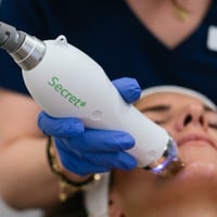 Secret RF Microneedling