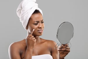 Banish the blemish